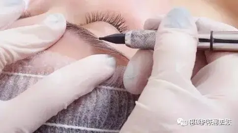 可见一“斑”,色斑及色沉的预防及治疗!-可见一斑为什么是斑点的斑?