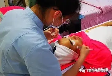 可见一“斑”,色斑及色沉的预防及治疗!-可见一斑为什么是斑点的斑?