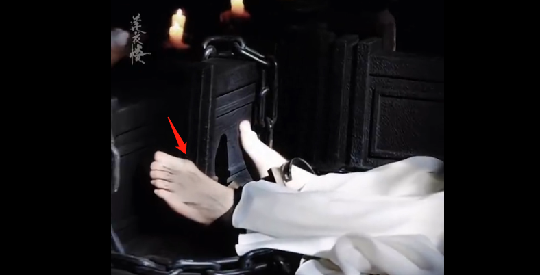 成毅缺陷曝光,拇指外翻遗传,团队撇清关系,网友建议就医治疗-成毅脸歪