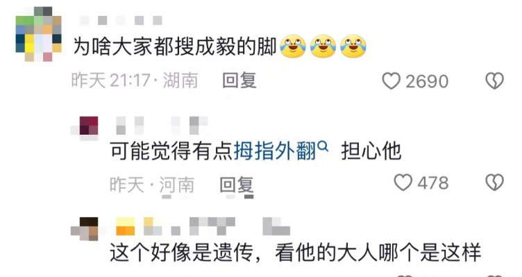 成毅缺陷曝光,拇指外翻遗传,团队撇清关系,网友建议就医治疗-成毅脸歪