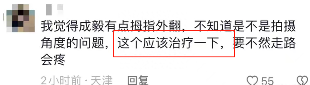 成毅缺陷曝光,拇指外翻遗传,团队撇清关系,网友建议就医治疗-成毅脸歪