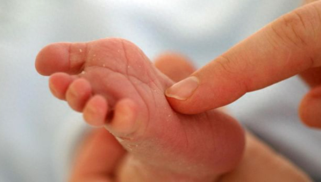 你是不怕痒技能满点选手吗?-不怕痒代表什么