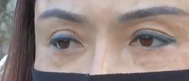 花15500做面部提拉,女子术后只能戴口罩示人,医师回应令人愤恨-面部提升带