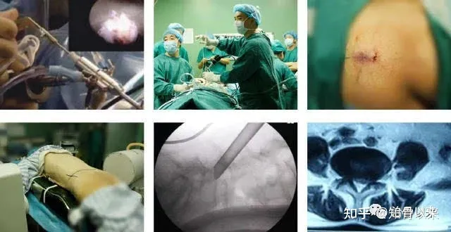 腰椎间盘突出症的治疗方法(完整版)-腰椎间盘突出症的治疗方式