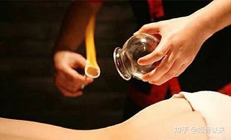 腰椎间盘突出症的治疗方法(完整版)-腰椎间盘突出症的治疗方式