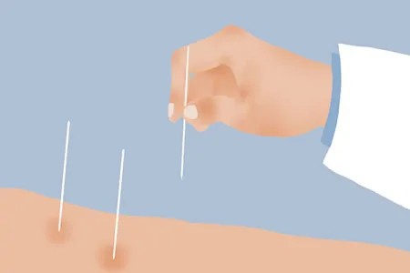 长期腰痛,多半是腰肌劳损所致,腰肌劳损该怎么护理和恢复?