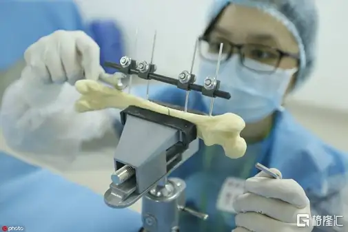 医疗器械集采靴子落地:春立医疗涨到停牌!