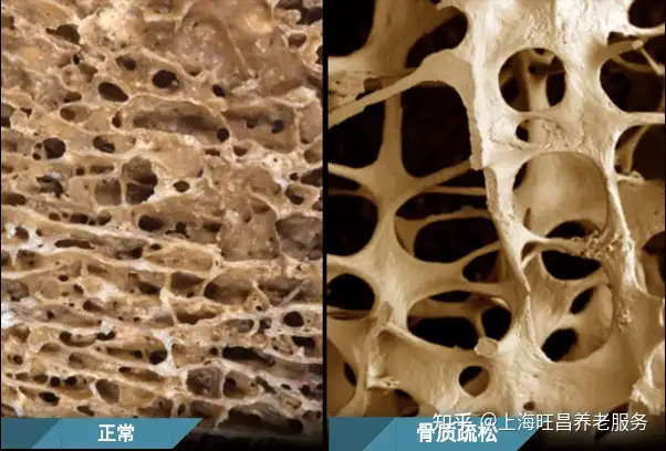 母亲节给妈妈的5条健康建议——人老了身体如何变化?