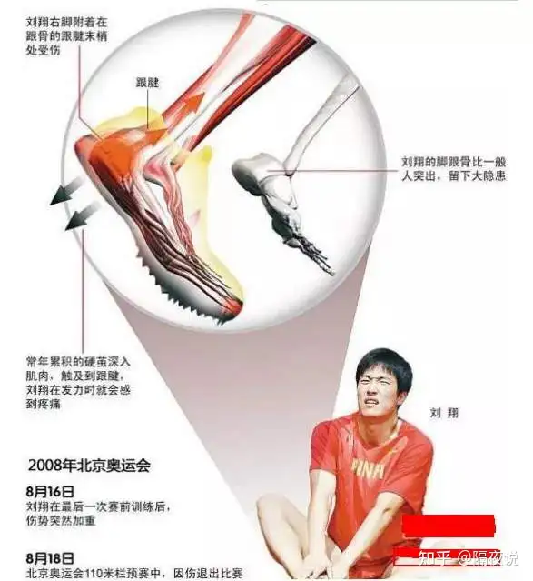 他是被键盘侠掩盖的奥运神话,13年后终于被正名!成为火影代言人