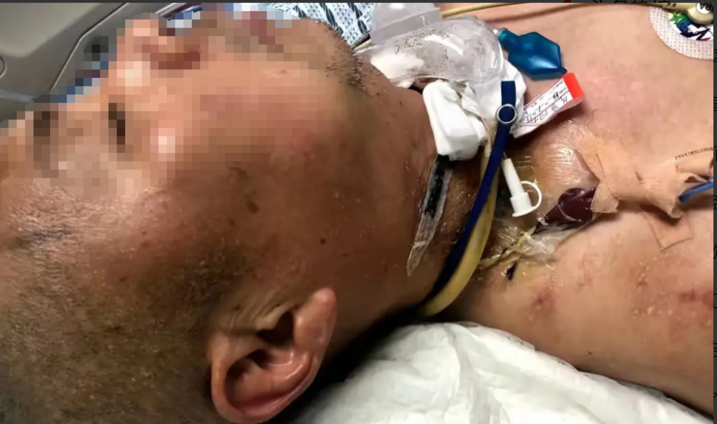 闹大了!比亚迪车漏电致车主住ICU后续:女儿回应,评论区却一边倒