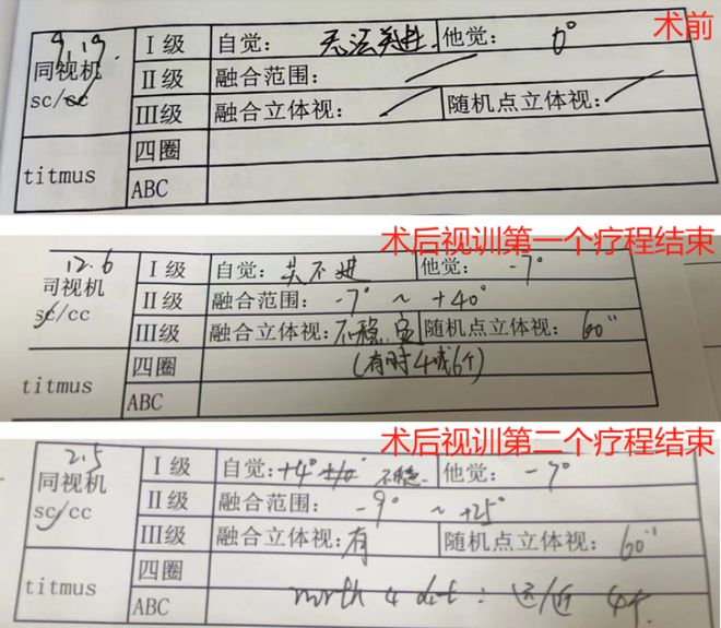 无法“正眼”看人,宁德女子忍了30多年……最终在这家医院解开心结