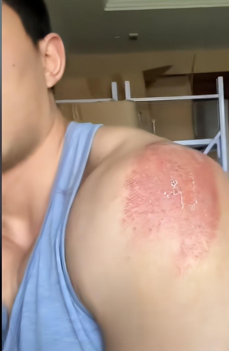 女子参加《快乐向前冲》摔断腿,参赛人员爆出90%的人都有受伤