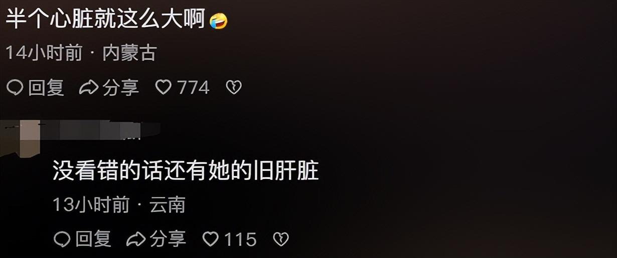 闹大了,新西兰女子携带心脏入境澳大利亚,评论区网友炸锅了!-新西兰女子过铁路