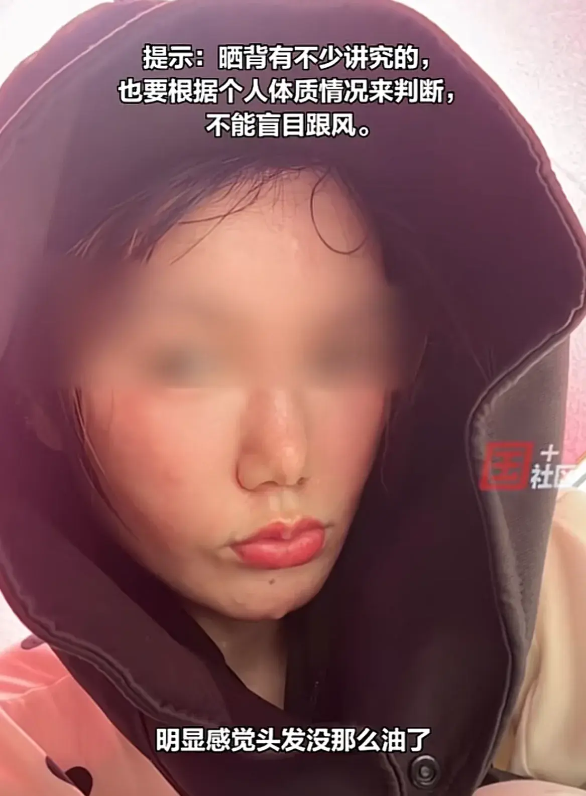 女子夏天楼顶晒后背,晒了10天瘦了4斤,网友:没中暑是奇迹-楼顶晒东西