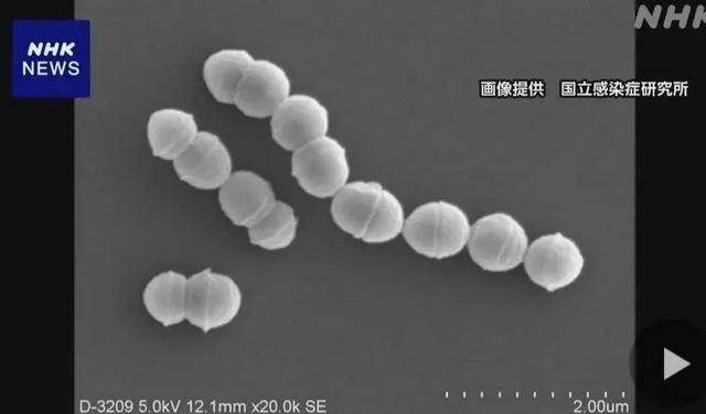 日本“食人菌”感染病例超1100例,多名孕产妇死亡-日本食人鱼事件