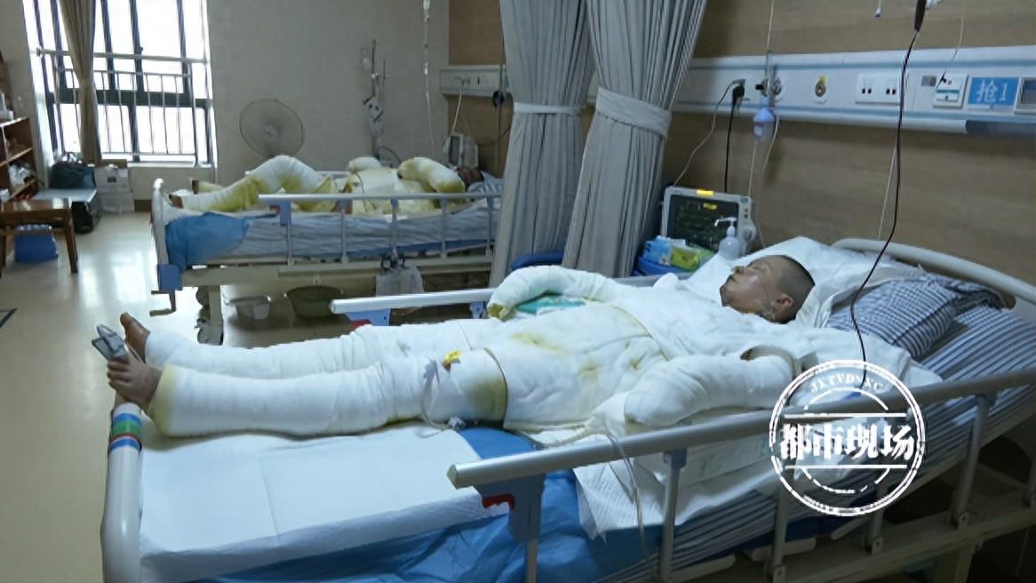 燃气爆燃!夫妻俩被严重烧伤,家境困难盼望救助-燃气爆炸烧伤图片