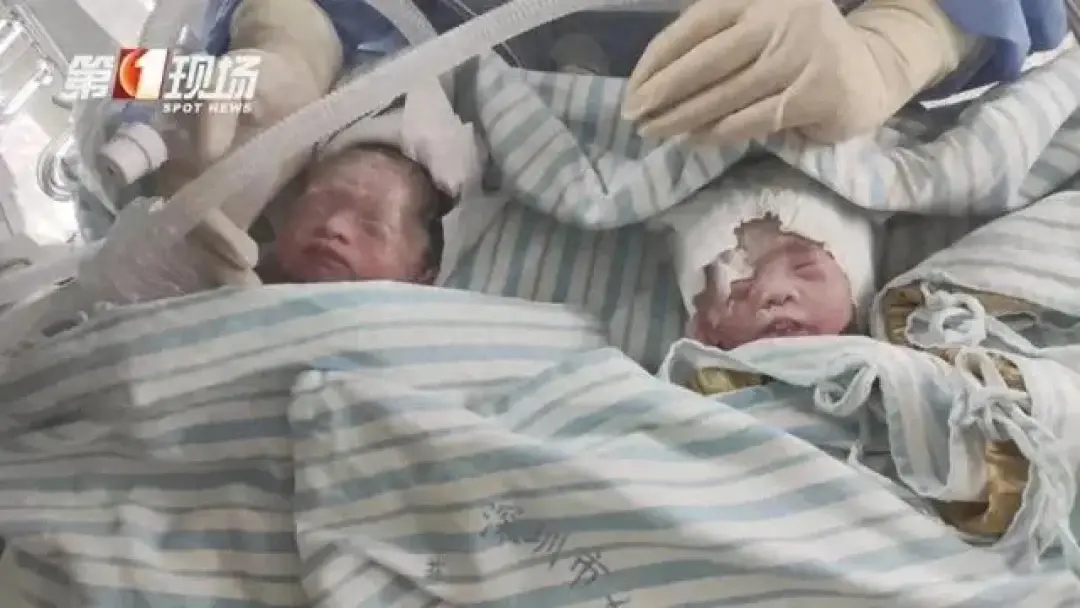 4胞胎父亲称收入微薄 深圳妇联回应:社区街道都会介入-深圳四胞胎事件处理