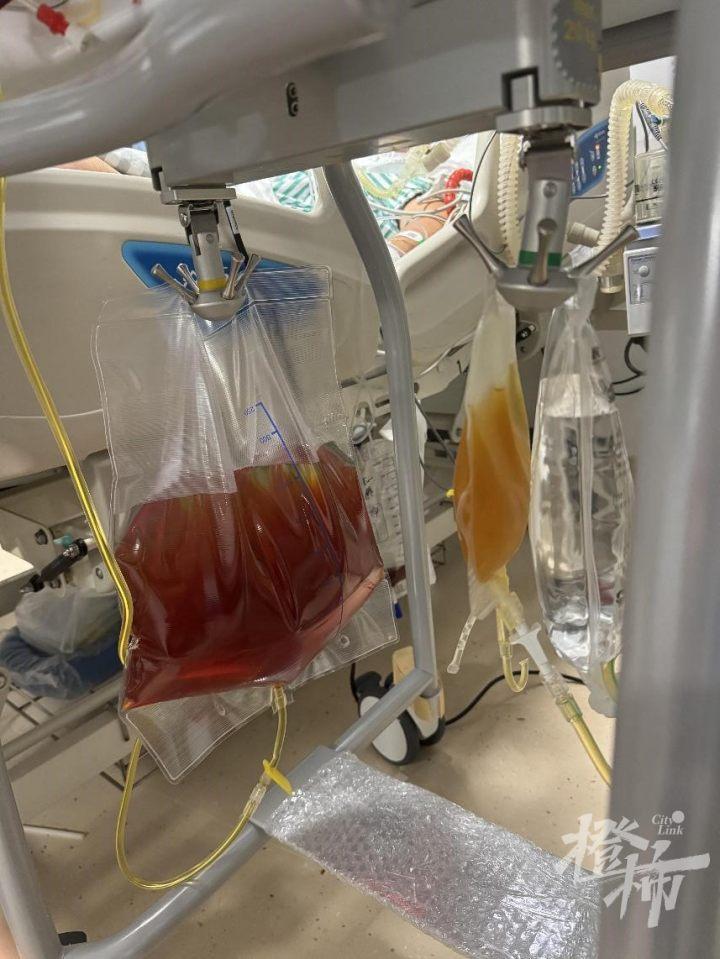 老婆景区里采了6朵蘑菇,老公吃完住进ICU!医生仔细一看:1朵足可致命