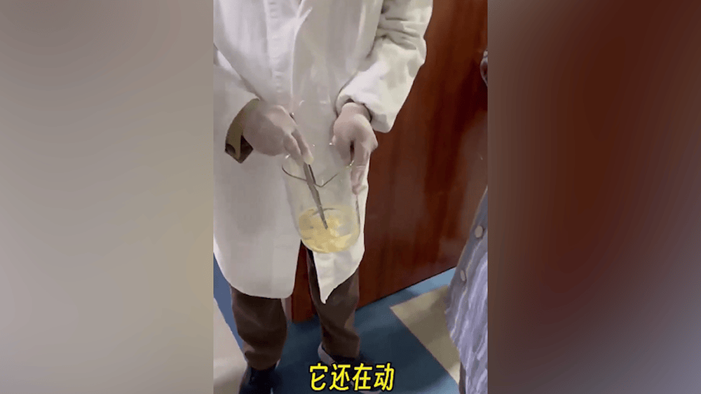 女子肛门处刺痒难忍,医院用“南瓜籽+槟榔”驱虫排出长达10米寄生虫-女性肛门里面瘙痒用什么药膏好