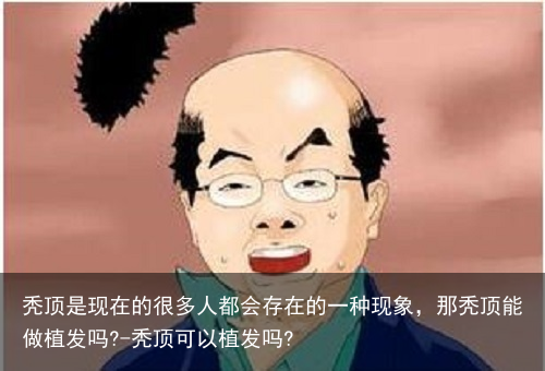 秃顶是现在的很多人都会存在的一种现象，那秃顶能做植发吗?-秃顶可以植发吗?