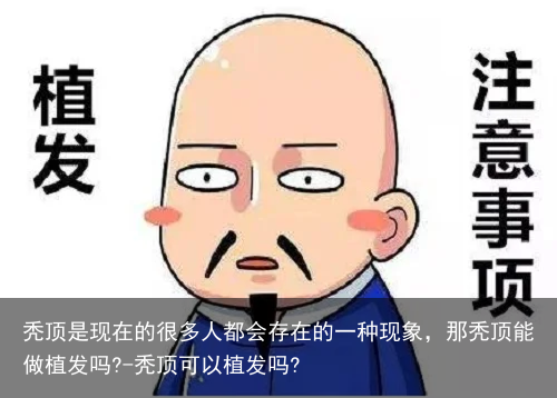 秃顶是现在的很多人都会存在的一种现象，那秃顶能做植发吗?-秃顶可以植发吗?