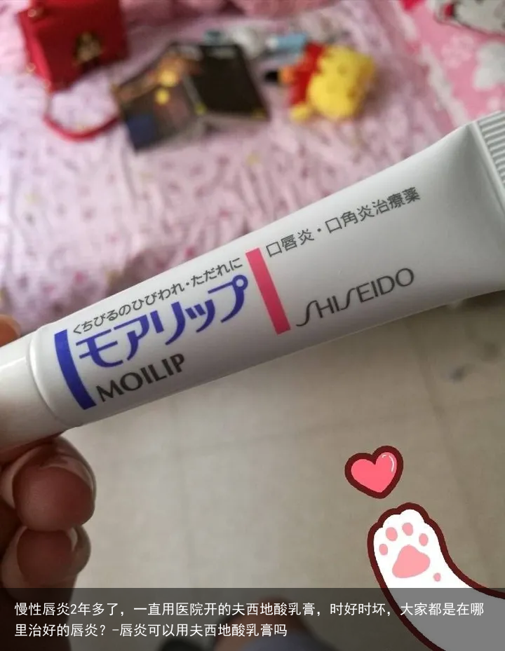 慢性唇炎2年多了，一直用医院开的夫西地酸乳膏，时好时坏，大家都是在哪里治好的唇炎？-唇炎可以用夫西地酸乳膏吗