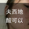 夫西地酸可以单独使用吗？-夫西地酸只能点涂吗