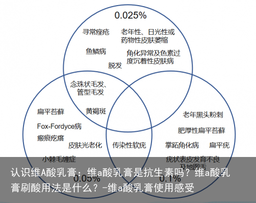 认识维A酸乳膏：维a酸乳膏是抗生素吗？维a酸乳膏刷酸用法是什么？-维a酸乳膏使用感受