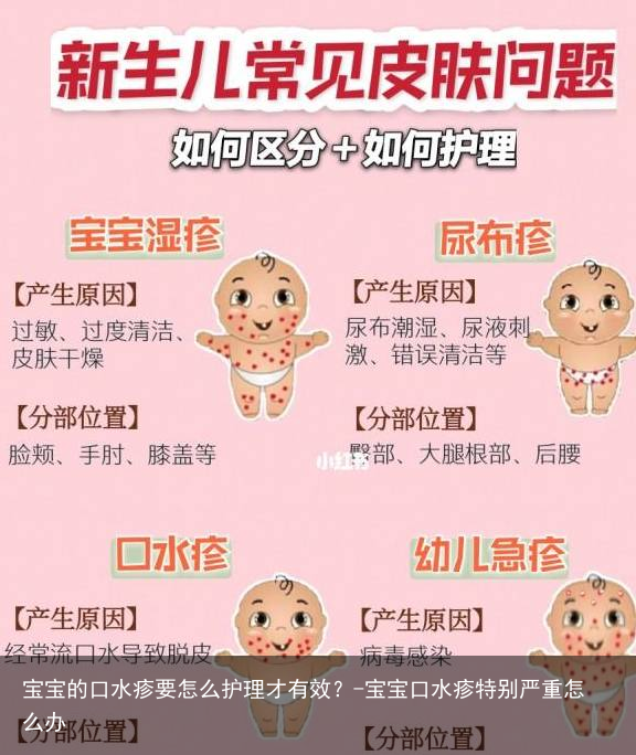 宝宝的口水疹要怎么护理才有效？-宝宝口水疹特别严重怎么办