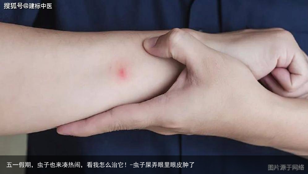 五一假期，虫子也来凑热闹，看我怎么治它！-虫子屎弄眼里眼皮肿了