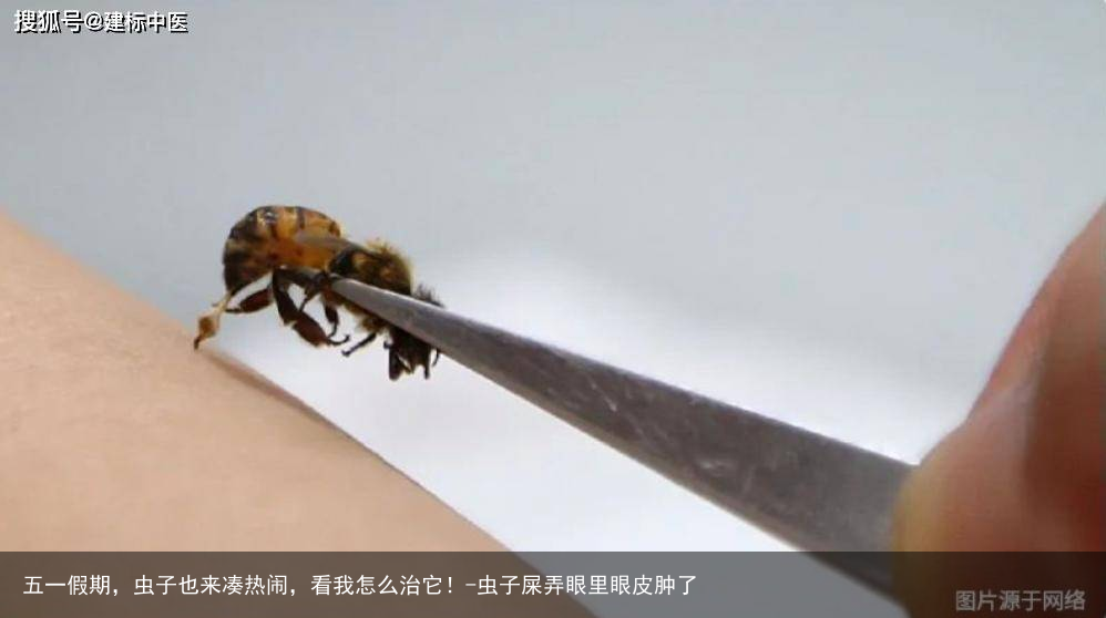 五一假期，虫子也来凑热闹，看我怎么治它！-虫子屎弄眼里眼皮肿了