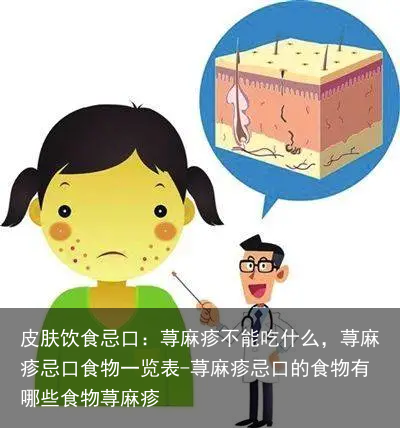 皮肤饮食忌口：荨麻疹不能吃什么，荨麻疹忌口食物一览表-荨麻疹忌口的食物有哪些食物荨麻疹