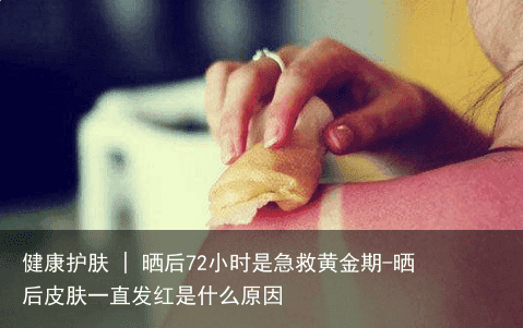 健康护肤 | 晒后72小时是急救黄金期-晒后皮肤一直发红是什么原因