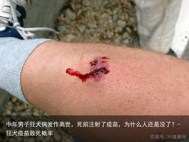 中年男子狂犬病发作离世，死前注射了疫苗，为什么人还是没了？-狂犬疫苗致死概率