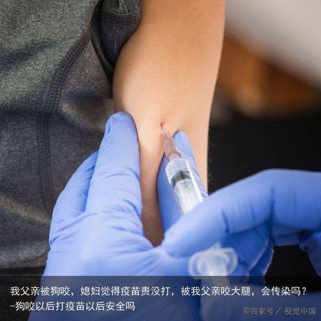 我父亲被狗咬，媳妇觉得疫苗贵没打，被我父亲咬大腿，会传染吗？-狗咬以后打疫苗以后安全吗