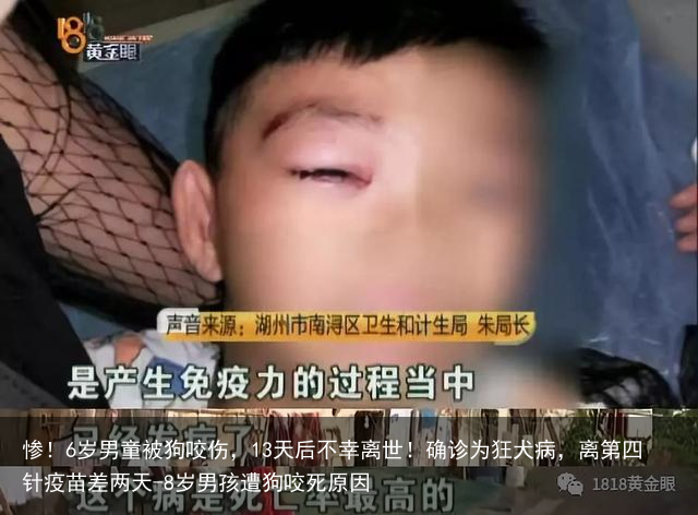 惨！6岁男童被狗咬伤，13天后不幸离世！确诊为狂犬病，离第四针疫苗差两天-8岁男孩遭狗咬死原因