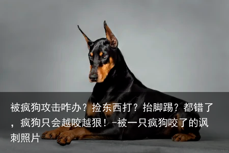 被疯狗攻击咋办？捡东西打？抬脚踢？都错了，疯狗只会越咬越狠！-被一只疯狗咬了的讽刺照片