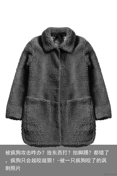 被疯狗攻击咋办？捡东西打？抬脚踢？都错了，疯狗只会越咬越狠！-被一只疯狗咬了的讽刺照片