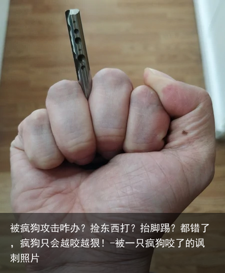 被疯狗攻击咋办？捡东西打？抬脚踢？都错了，疯狗只会越咬越狠！-被一只疯狗咬了的讽刺照片