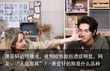 萧亚轩近照曝光，被狗咬伤脸后遗症明显，网友：“人皮面具”？-萧亚轩的狗是什么品种
