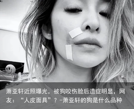 萧亚轩近照曝光，被狗咬伤脸后遗症明显，网友：“人皮面具”？-萧亚轩的狗是什么品种