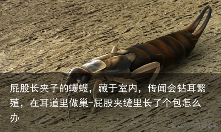 屁股长夹子的蠼螋，藏于室内，传闻会钻耳繁殖，在耳道里做巢-屁股夹缝里长了个包怎么办