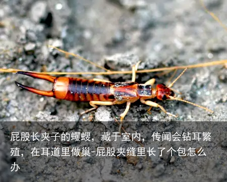 屁股长夹子的蠼螋，藏于室内，传闻会钻耳繁殖，在耳道里做巢-屁股夹缝里长了个包怎么办
