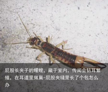 屁股长夹子的蠼螋，藏于室内，传闻会钻耳繁殖，在耳道里做巢-屁股夹缝里长了个包怎么办