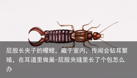 屁股长夹子的蠼螋，藏于室内，传闻会钻耳繁殖，在耳道里做巢-屁股夹缝里长了个包怎么办