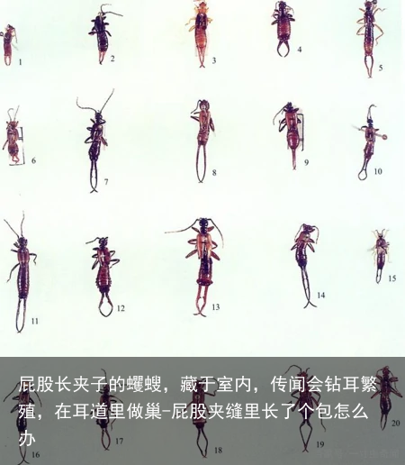 屁股长夹子的蠼螋，藏于室内，传闻会钻耳繁殖，在耳道里做巢-屁股夹缝里长了个包怎么办