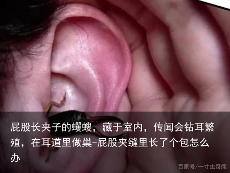 屁股长夹子的蠼螋，藏于室内，传闻会钻耳繁殖，在耳道里做巢-屁股夹缝里长了个包怎么办