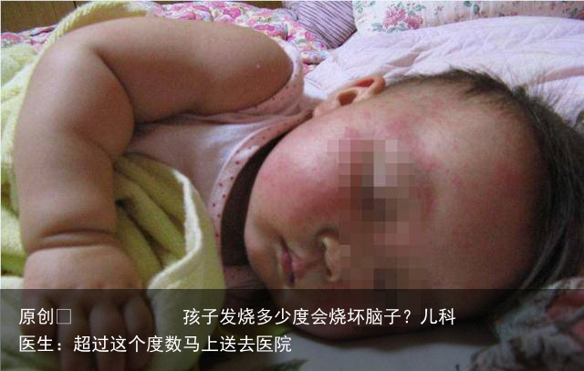 孩子发烧多少度会烧坏脑子？儿科医生：超过这个度数马上送去医院