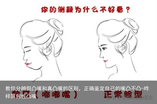 教你分辨假凸嘴和真凸嘴的区别，正确鉴定自己的嘴凸不凸-咋样算假性凸嘴