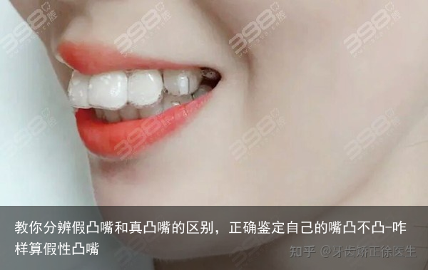 教你分辨假凸嘴和真凸嘴的区别，正确鉴定自己的嘴凸不凸-咋样算假性凸嘴